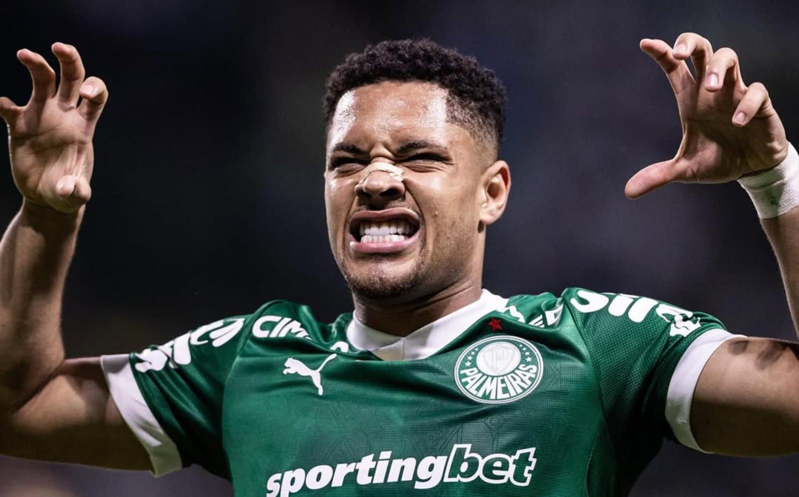 Palmeiras confirma lesão de Vitor Roque e atacante passará por cirurgia; confira